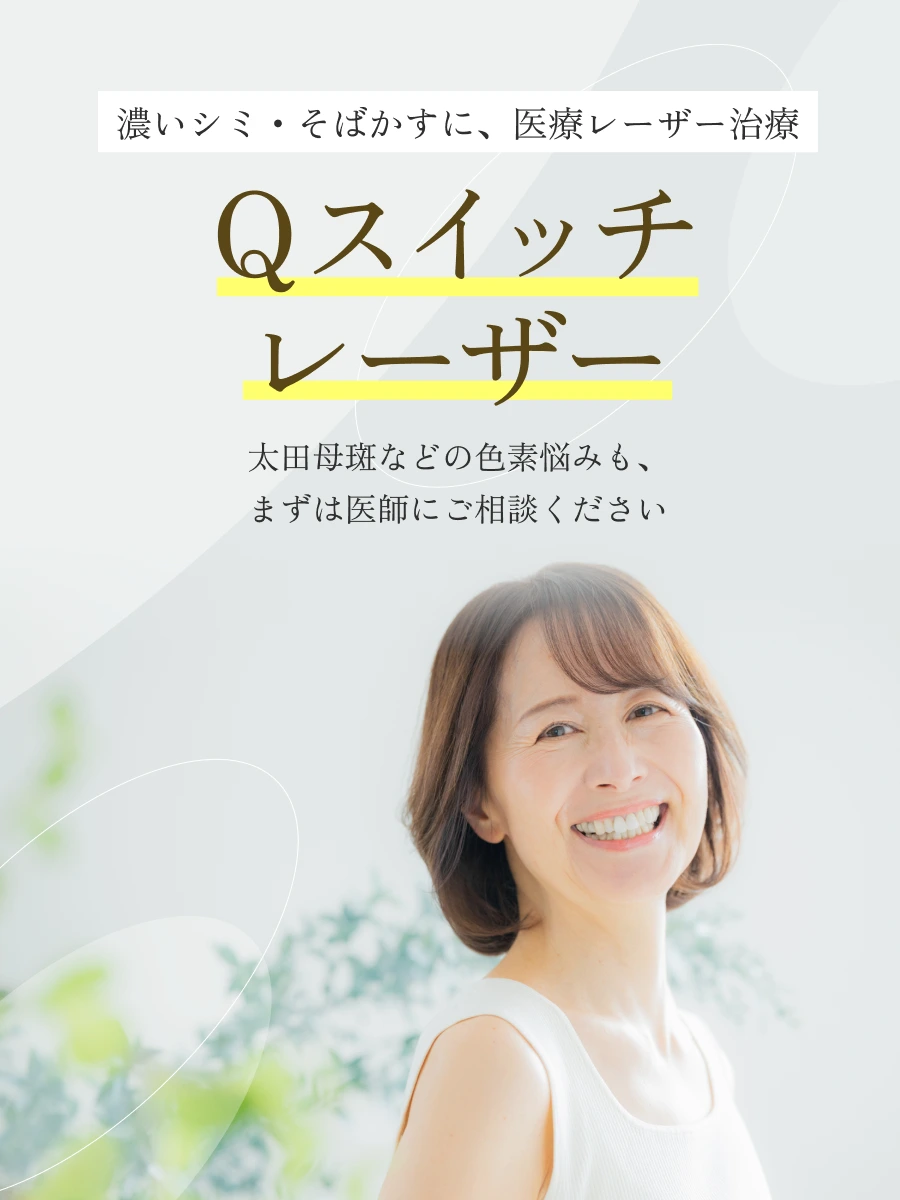 Qスイッチレーザー
